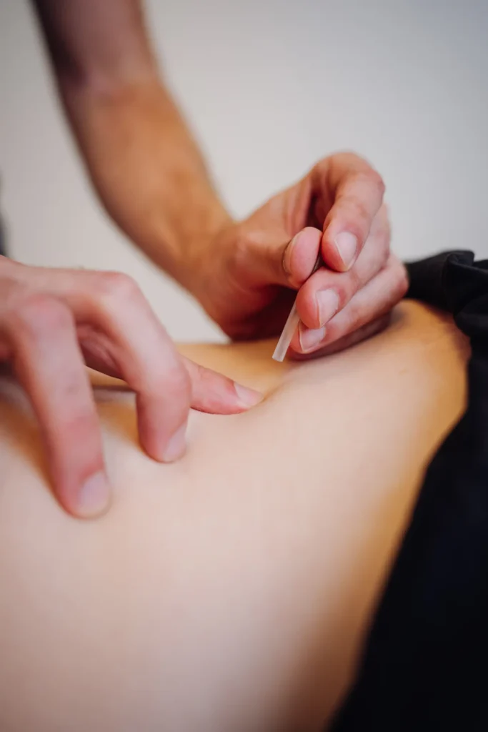 Bob die dry needling toepast