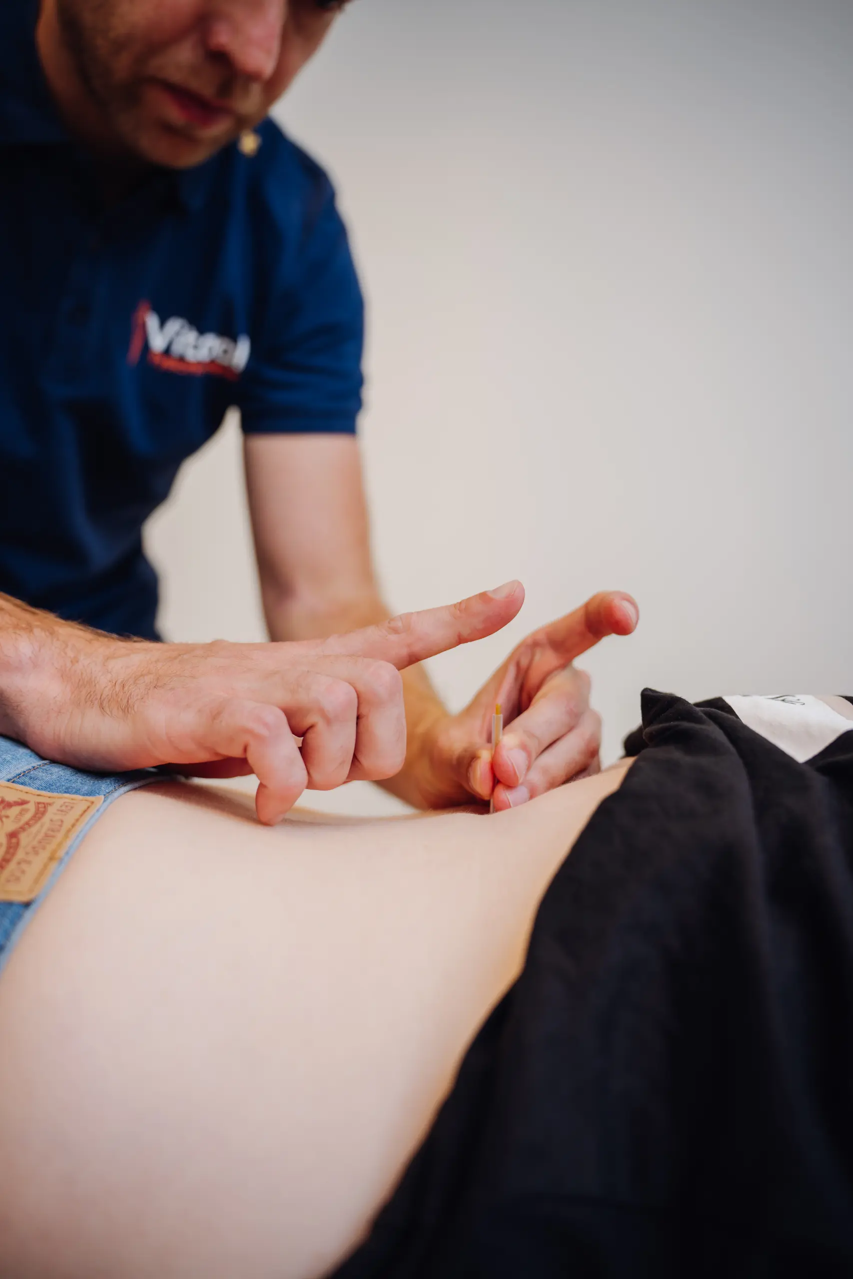 Bob die dry needling toepast